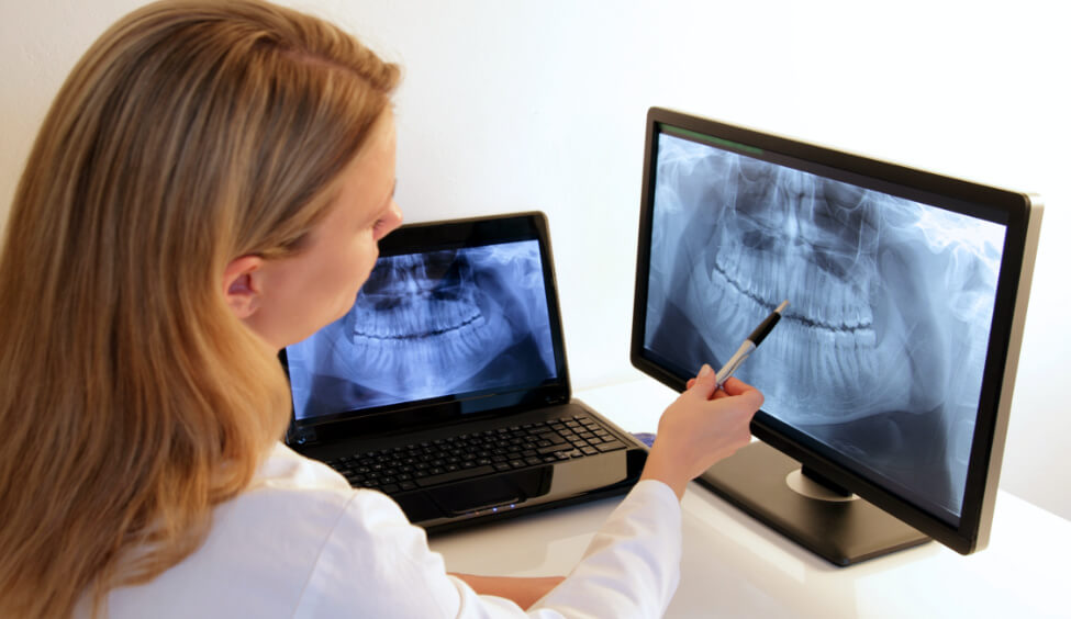 Digital-X-Rays