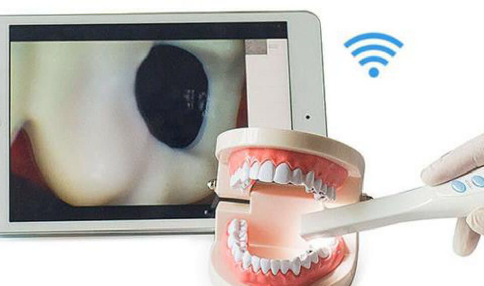 Intra-Oral-Camera
