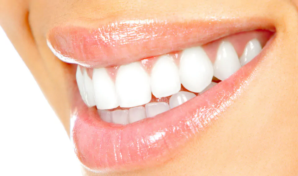 Smile-Makeovers